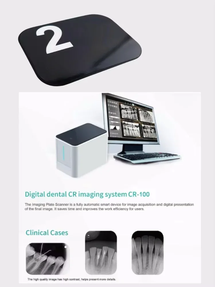 High Resolution Dental Digital X-Ray Phosphor Plates - Metal-Free Imaging Sensors for Professional Dentistry