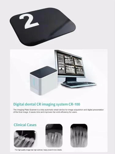 Imagen 2 del producto Placas de fósforo de rayos X digitales dentales de alta resolución: sensores de imágenes sin metales para odontología profesional