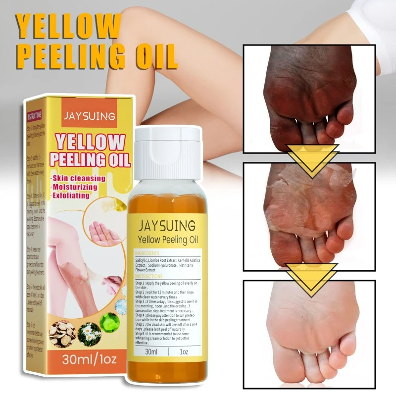 Aceite exfoliante de piel amarilla, hidratante, eliminación de piel de pollo, delicada, reparación de la piel, ilumina el amarillo, mejora la sequedad del cuidado corporal