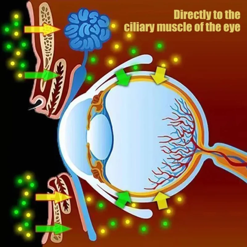 30 Days Immediate Drop -2.0 Diopter Improve Vision Eye Patch Relieve Myopia Eye Fatigue Dry Blurry Help Sleep Remove Dark Circle