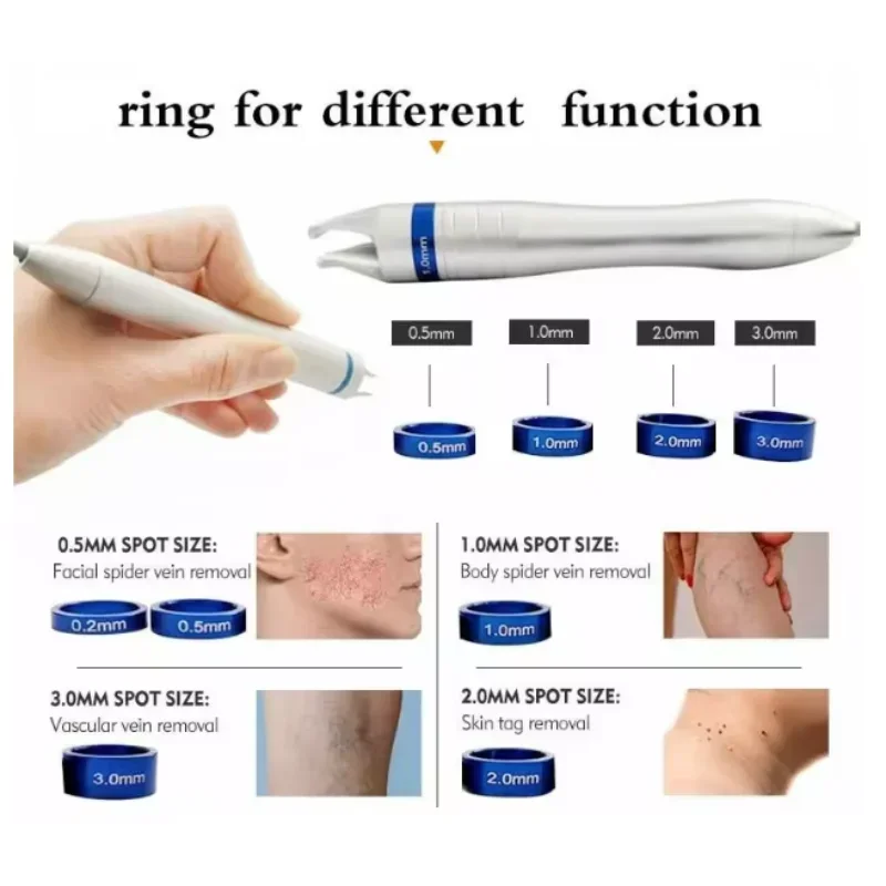 

Лучший диодный лазер Cenmade 980 нм 30 Вт 2024 года для удаления сосудистых звездочек, лечения грибка ногтей и варикозного расширения вен