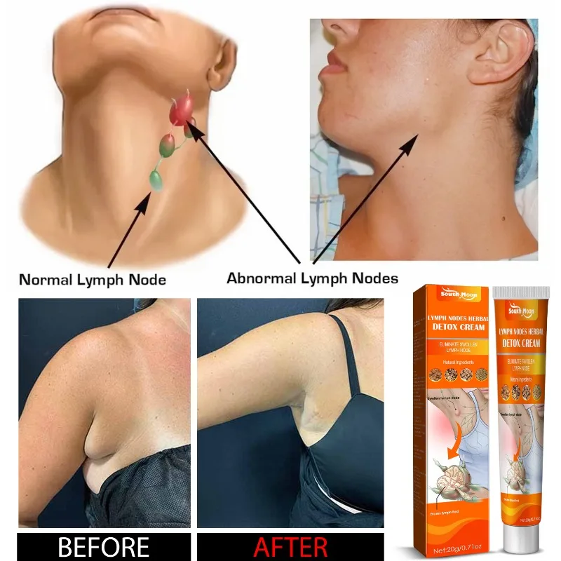 Lymphatic Health Care Ointment Detox Relieves Dredging Improves Neck Breast Armpit Anti-Swelling Lymph Node Repair Massage Cream