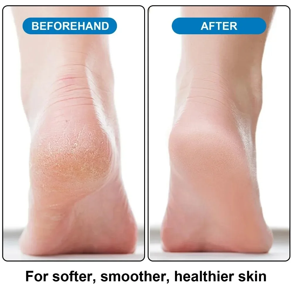 مزيل مسامير القدم الفعال حجر الخفاف ملف القدم أداة تقشير الجلد الميت للأقدام الخامة باديكير أداة تنظيف العناية بالقدم #4