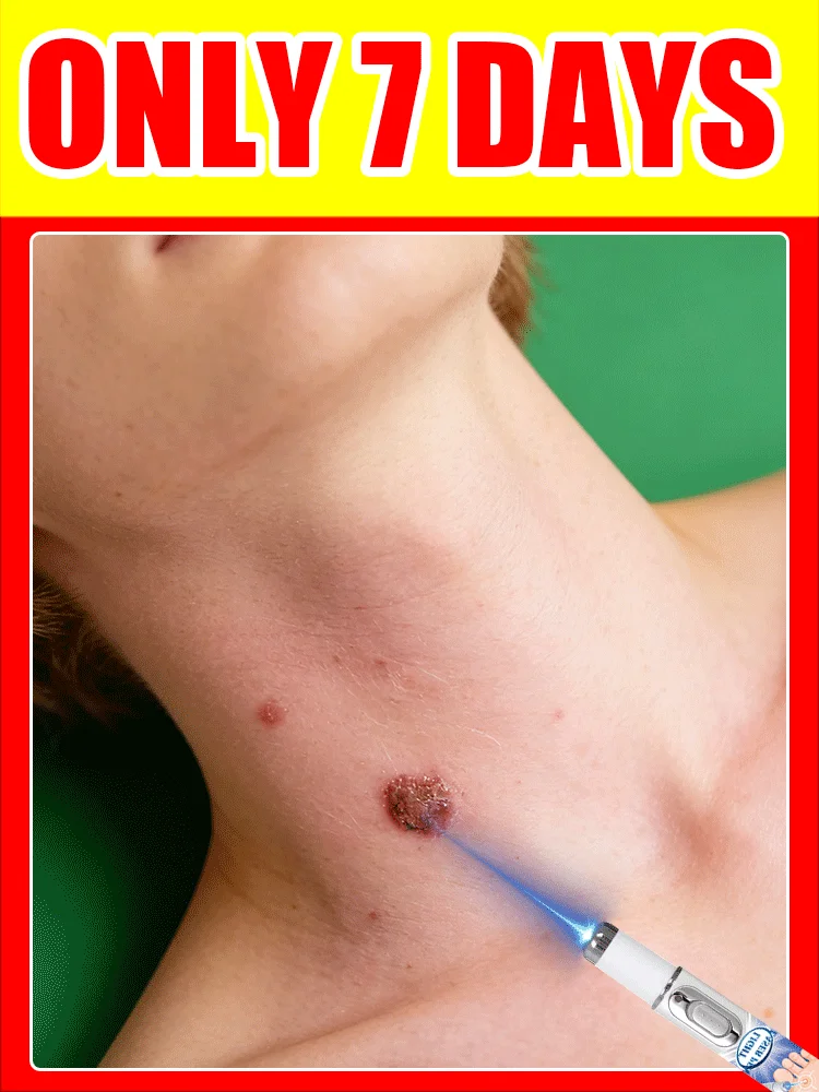 

Новейшие инструменты для ремонта шрамов и рубцов с технологией быстрого восстановления (2026). Обновленные технологии меняют жизнь.