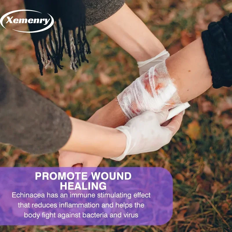 كبسولات إشنسا 400 ملجم - تدعم صحة المناعة والتنفس وتقليل طول مكمل البرد