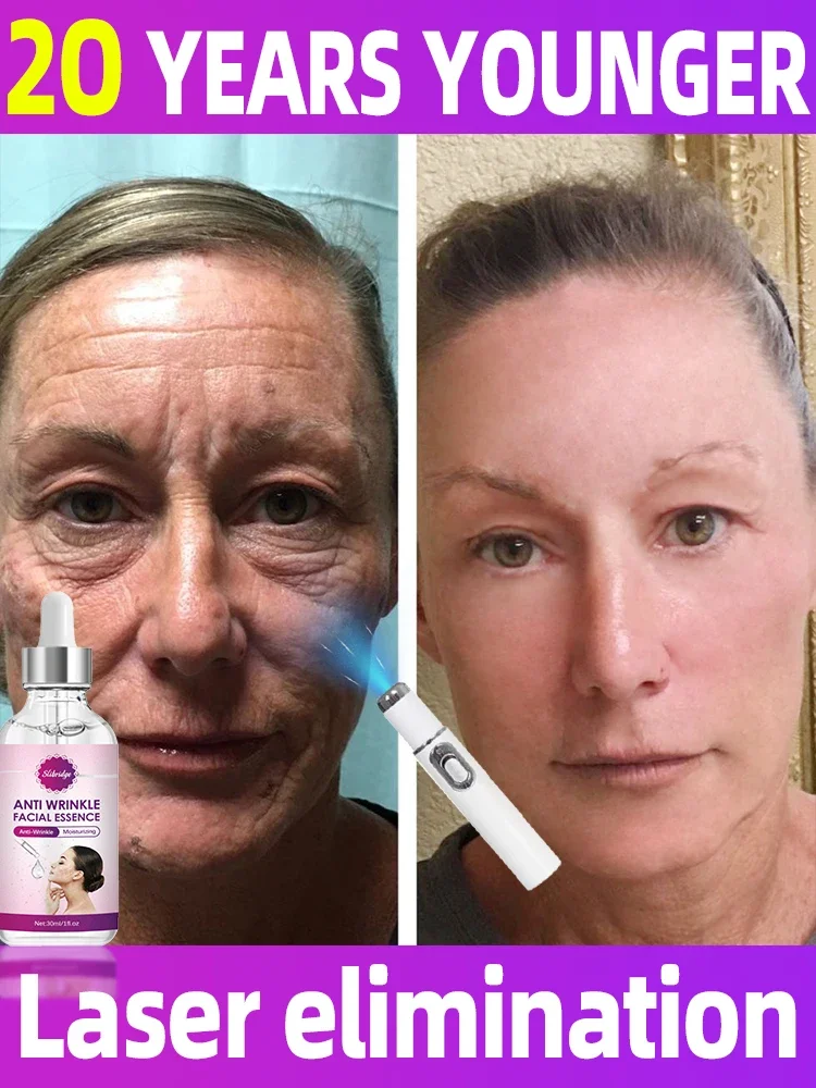 Solve all facial wrinkle problems