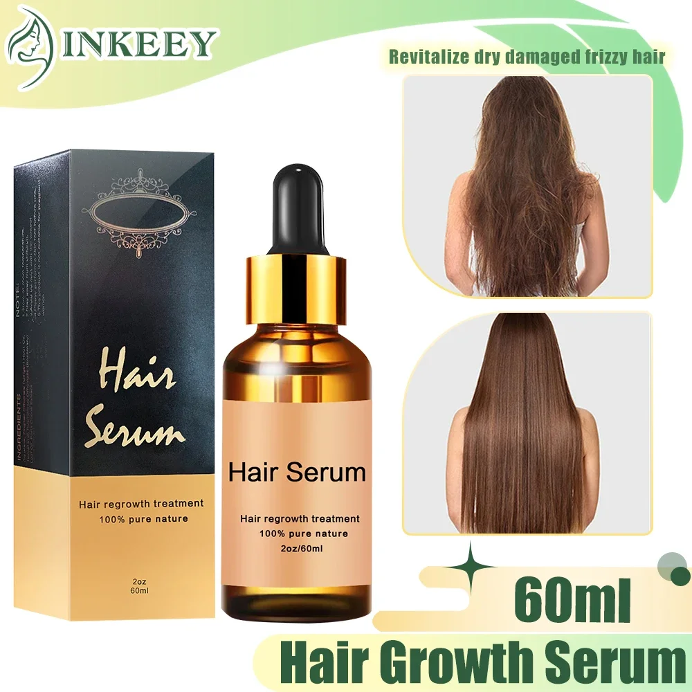 

60ml Hair Growth Serum Prevent Hair Loss Treatment Thinning Alopecia Liquid Dry Damaged Hair Repair for Stronger Thicker Hair