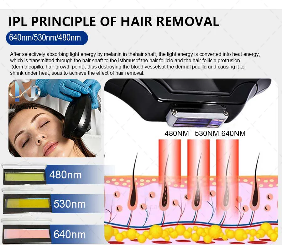 4 In 1 Soprano Titanium Ice Laser Hair Removal Device Alexandrite 808nm Diode Laser System Painless Permanent Body Hair Removal