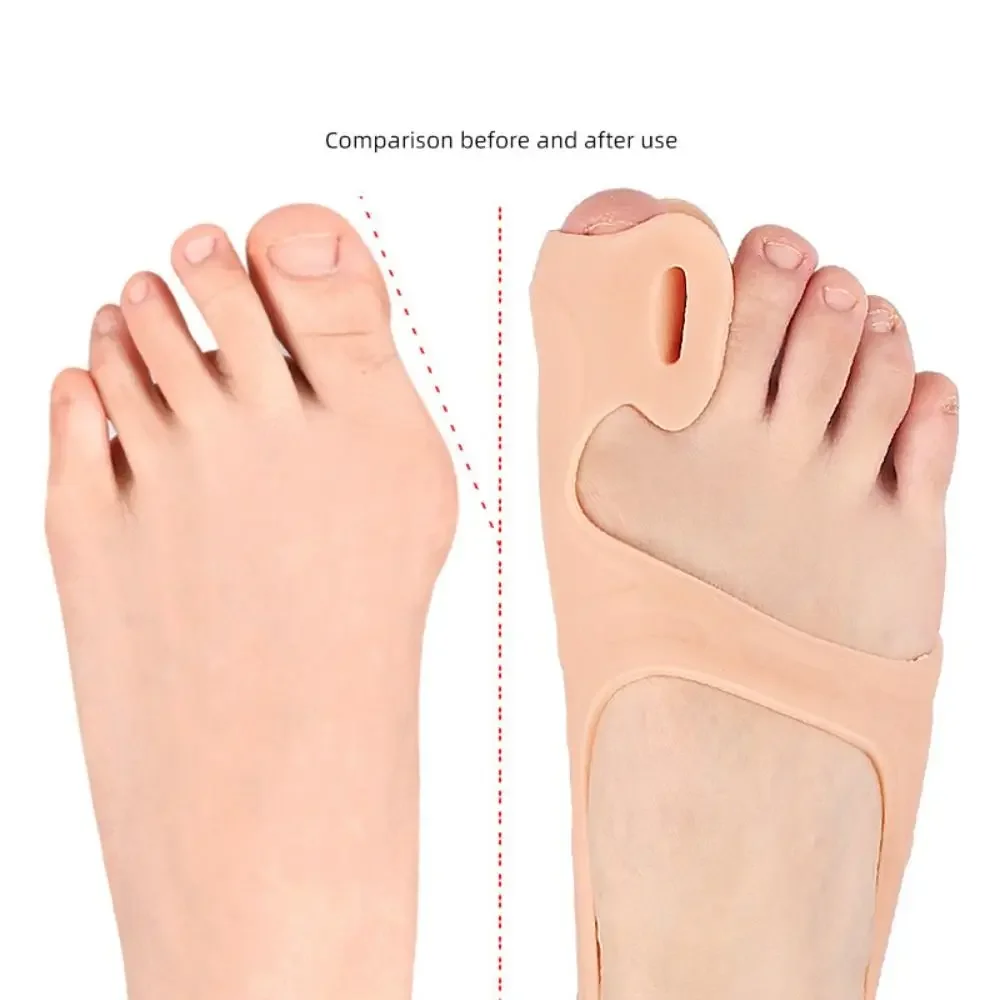 Nieuwe SEBS Tenen Separator Transparant Naakt Zachte Tenen Buitenapparaat Voetverzorging Gereedschap Bot Ectropion