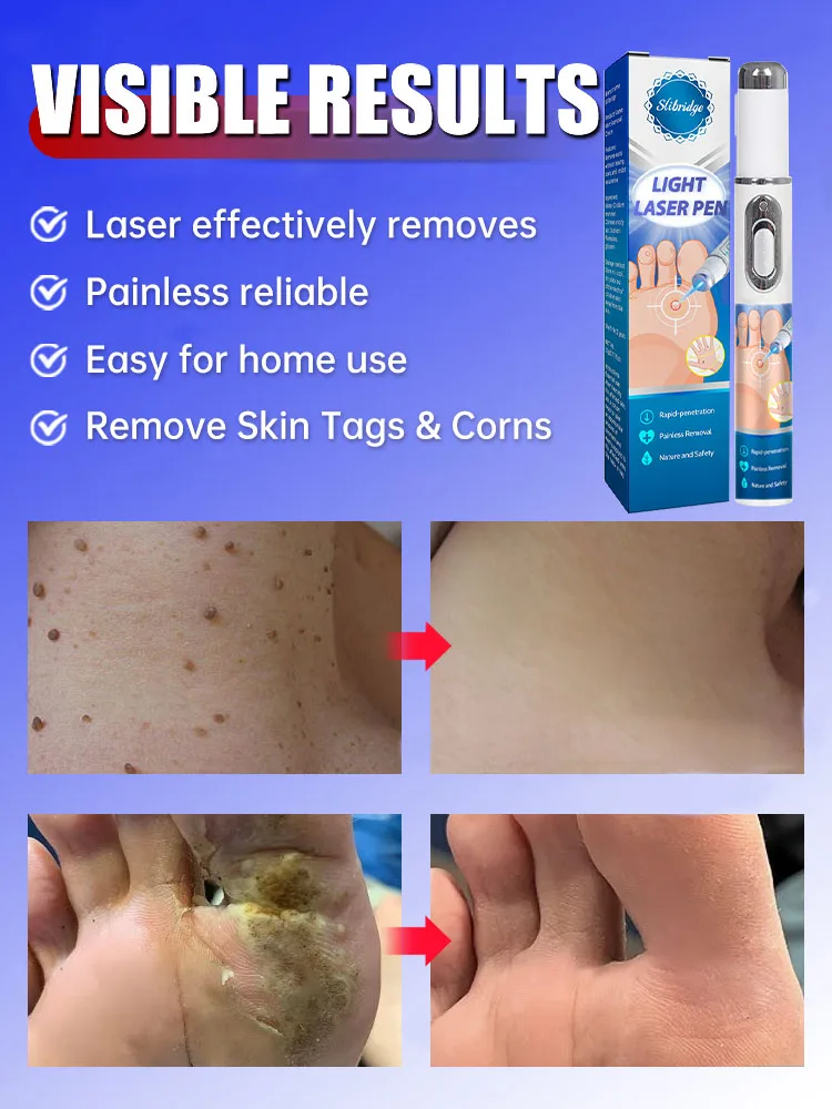 Migliora prima della fine luglio. Idratare e idratare la pelle.