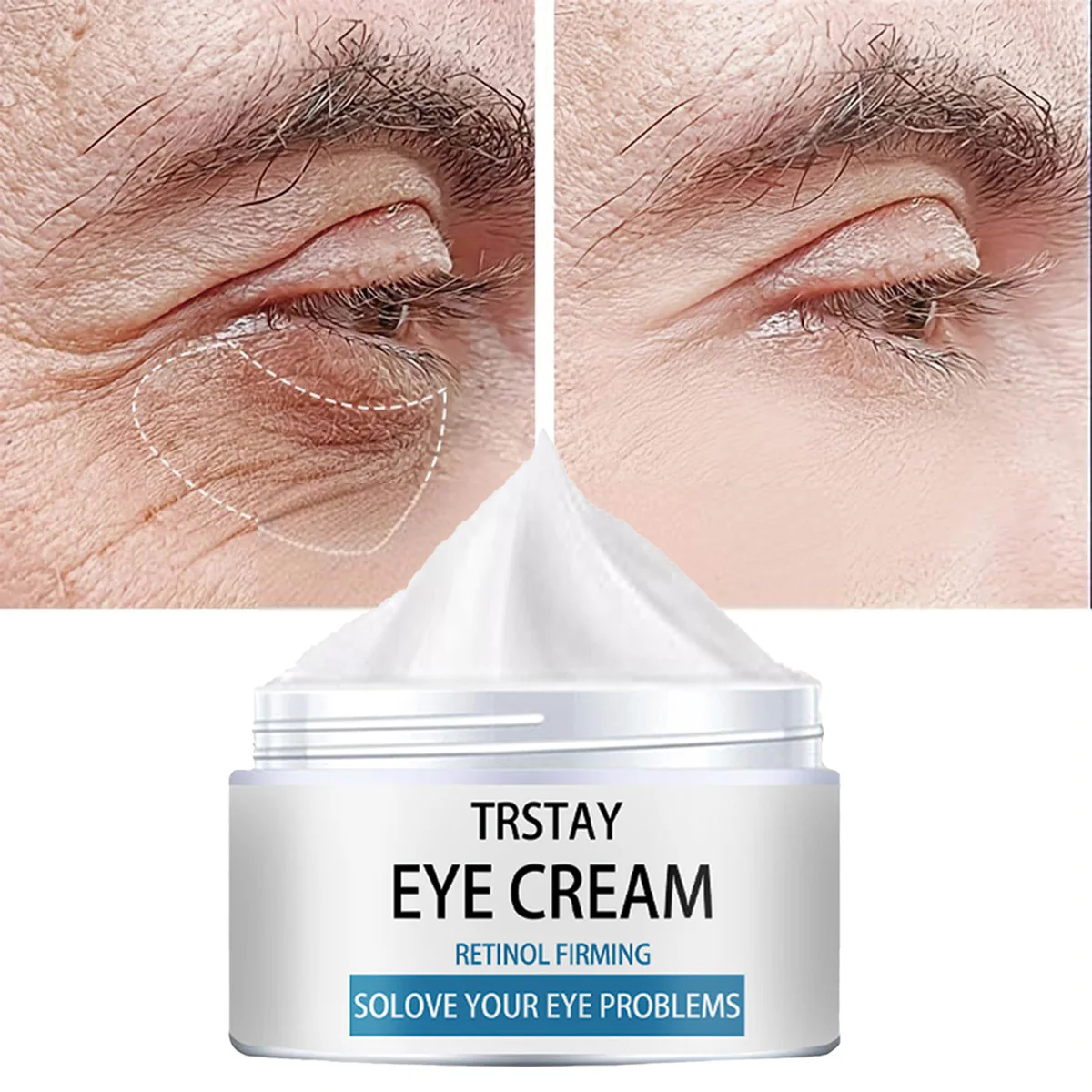 

Крем для глаз TRSTAY с ретинолом, укрепляющий антиоксидантный уход за кожей для мам и детей решает проблемы под глазами