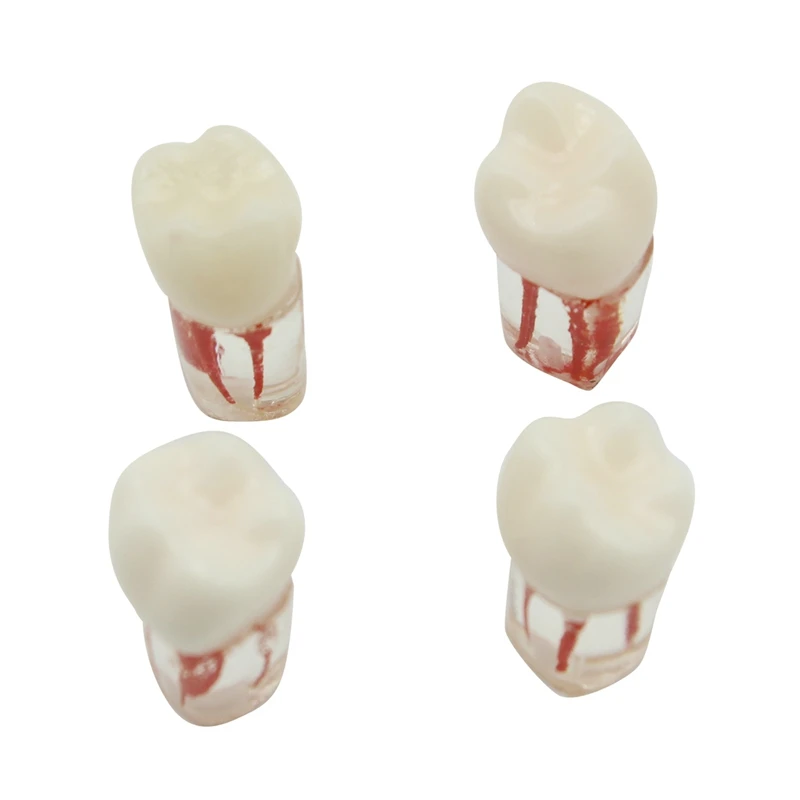 

4PCS Dental Tooth Model Endodontic Root Canal Block RCT Practice Pulp Cavity Dentistry Replace Resin Teeth Endo Training Tools