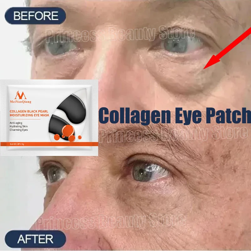 Eyes Bag Remove Collagen Eye Patch Instant Fade Fine Line Dark Circles Fat Particles Moisturizing Anti-Puffiness Korea Eye Care