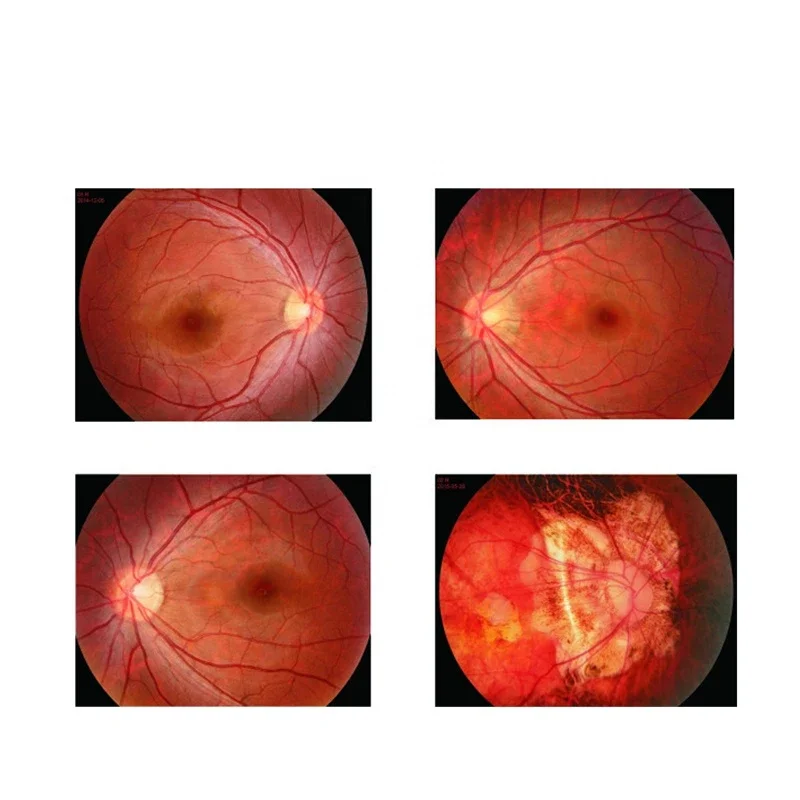 Ophthalmology Examination Equipment Desk Top Medical Non Mydriatic Digital Eye Fundus Camera