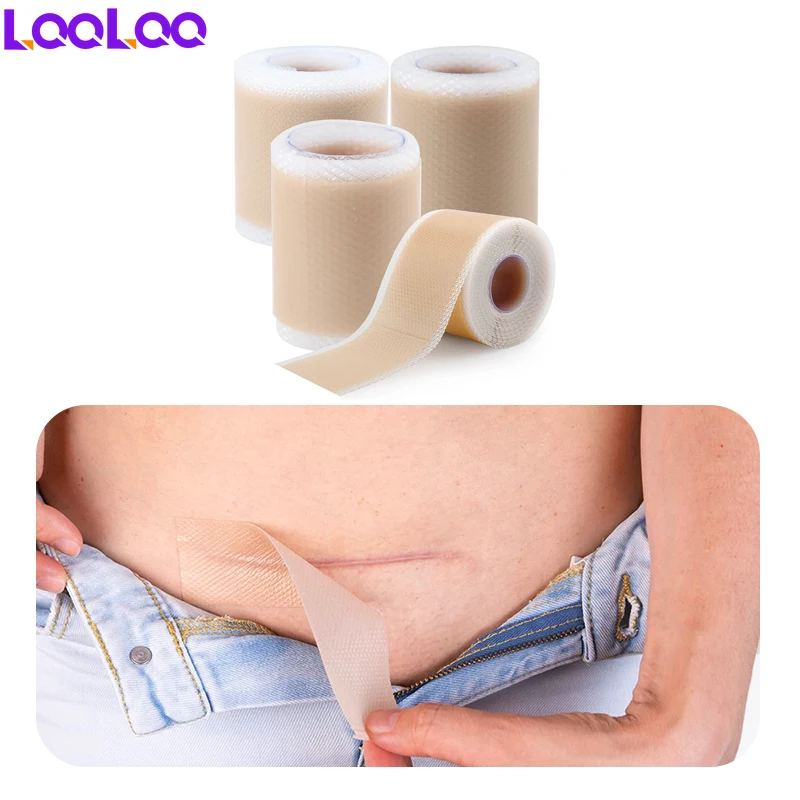 5Roll Sheets Keloid Bump Removal Strips,Scar Reducing Treatments for Surgical Scars,Stretch Mark Patch Away Wound Bandages