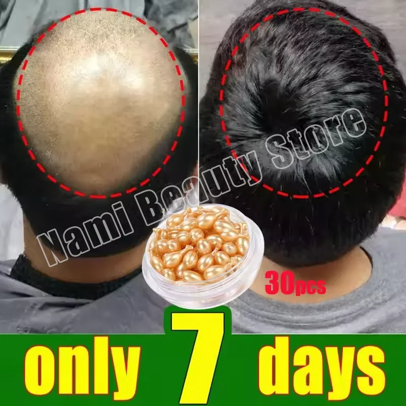 Hair Growth Serum 7 Days Fast Regrowth Essential Capsule Anti Hair loss Baldness Repair Damaged Scalp Treatment For Women Men