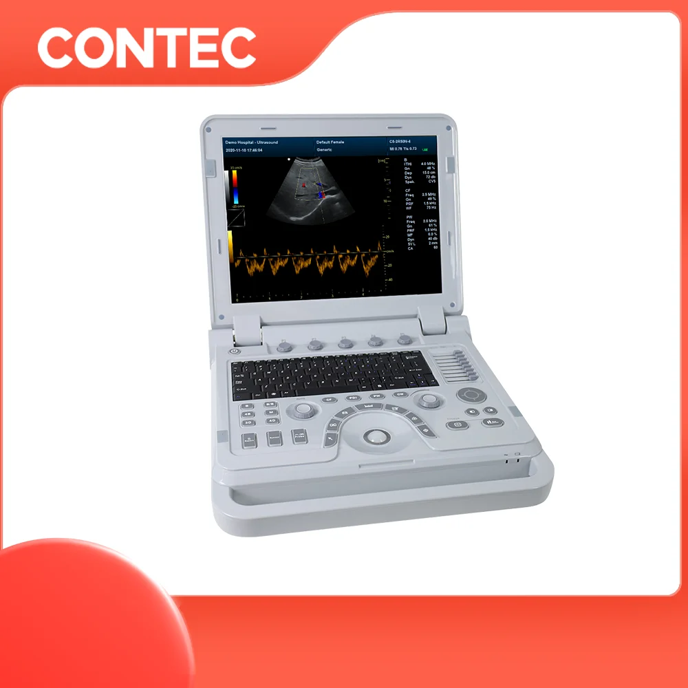 CONTEC high resolution color Doppler ultrasonic diagnostic device Ultrasound System