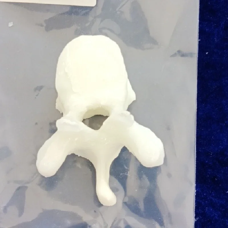 Spinal bone densitometry phantom