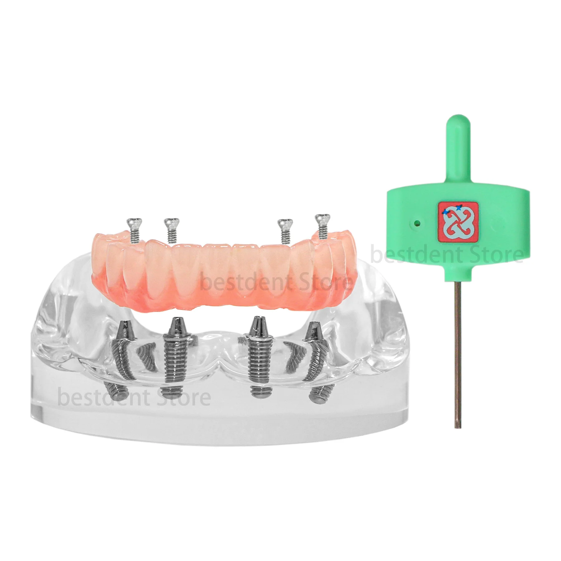 Dental Teeth Model Typodont Lower Jaw Implant Restoration Demo Practice Model with 4 Screws