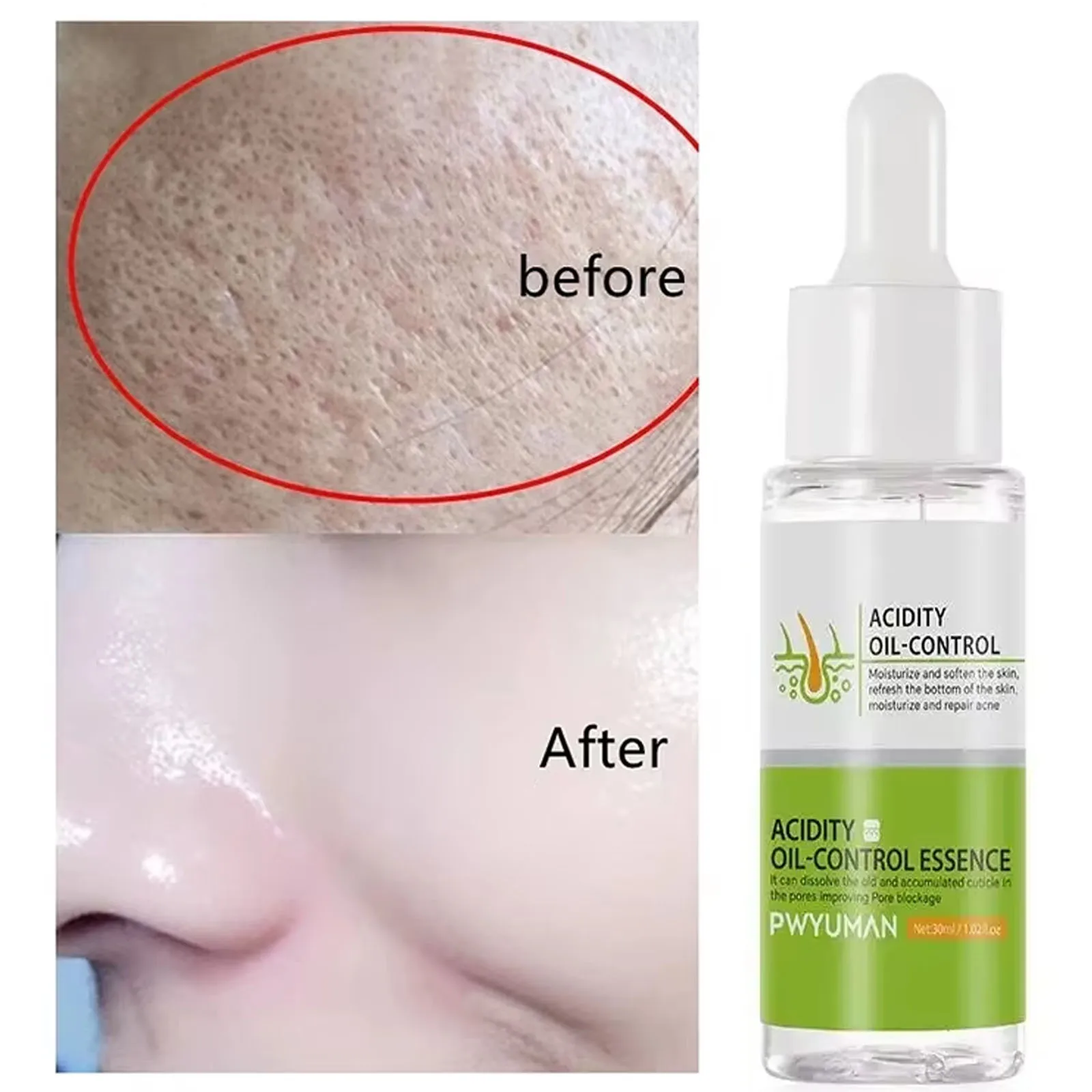 

Acidity Pore Shrink Face Serum Remove Blackheads Acne Oil Control Repair Essence Moisturizing Nourish Pores Firming Facial Care