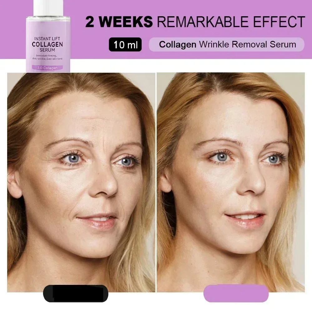 Anti-Rimpel Essence Lifting Verstevigende Afnemende Fijne Lijntjes Anti-Aging Serum Whitening Verheldering Voedende Gezichtsverzorging