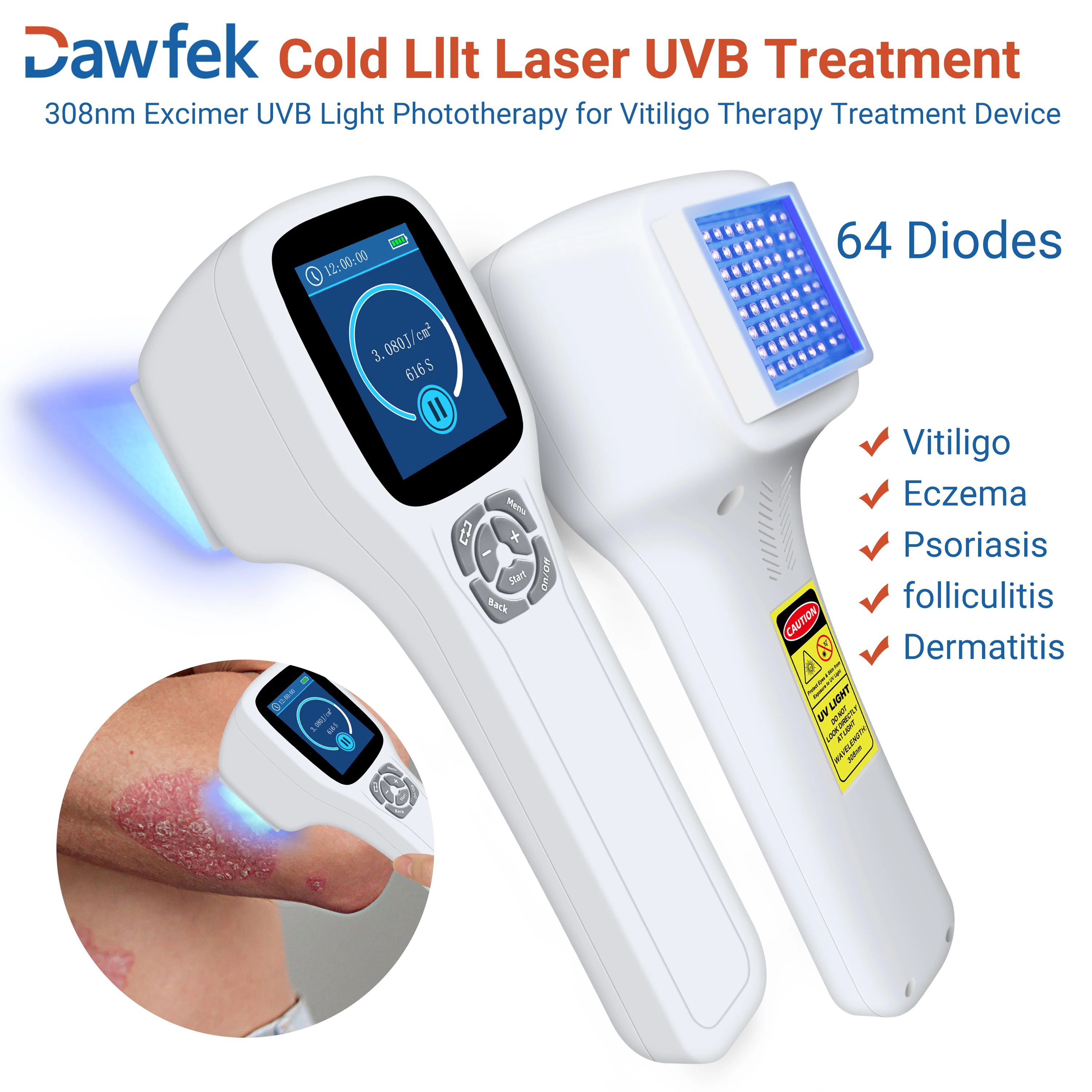 Dawfek Uv Light For Vitiligo Skin Rejuvenation 308Nm Vitiligo Treatment Machine For Psoriasis Allergic Dermatosis