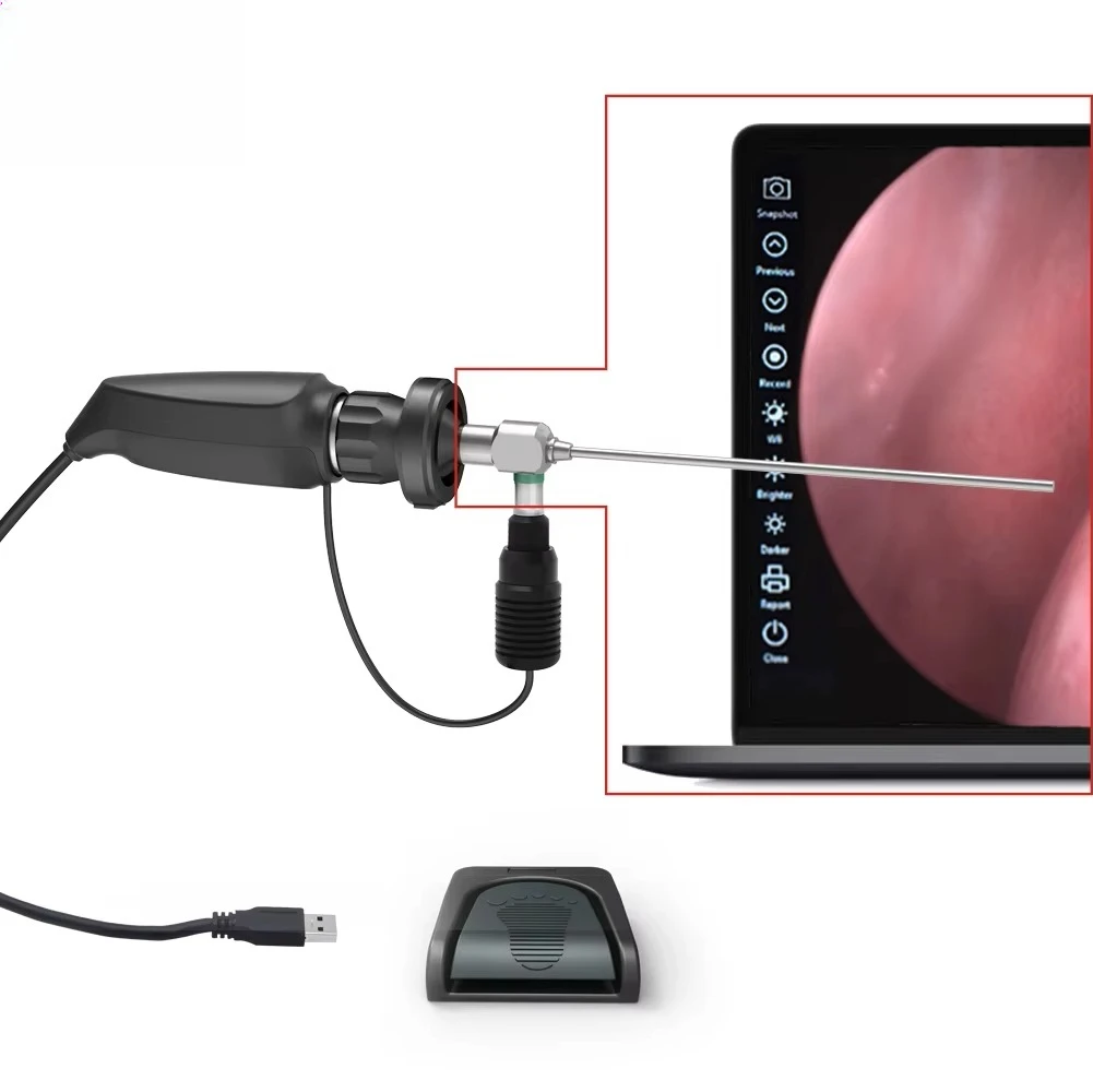 

HD-602K-2 5W Electric Portable Veterinary Endoscopy Camera LED Light Class I Black Medical Surgery ENT