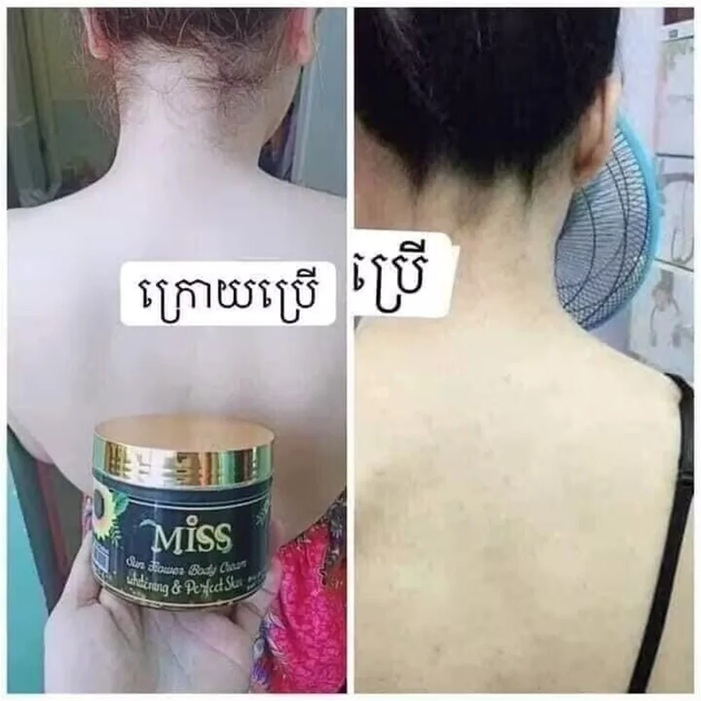 KEM BODY MISS THAI LAN Blanqueamiento Cuerpo Piel Oscura Aclaramiento Blanco Brillante Botella 170g/400g