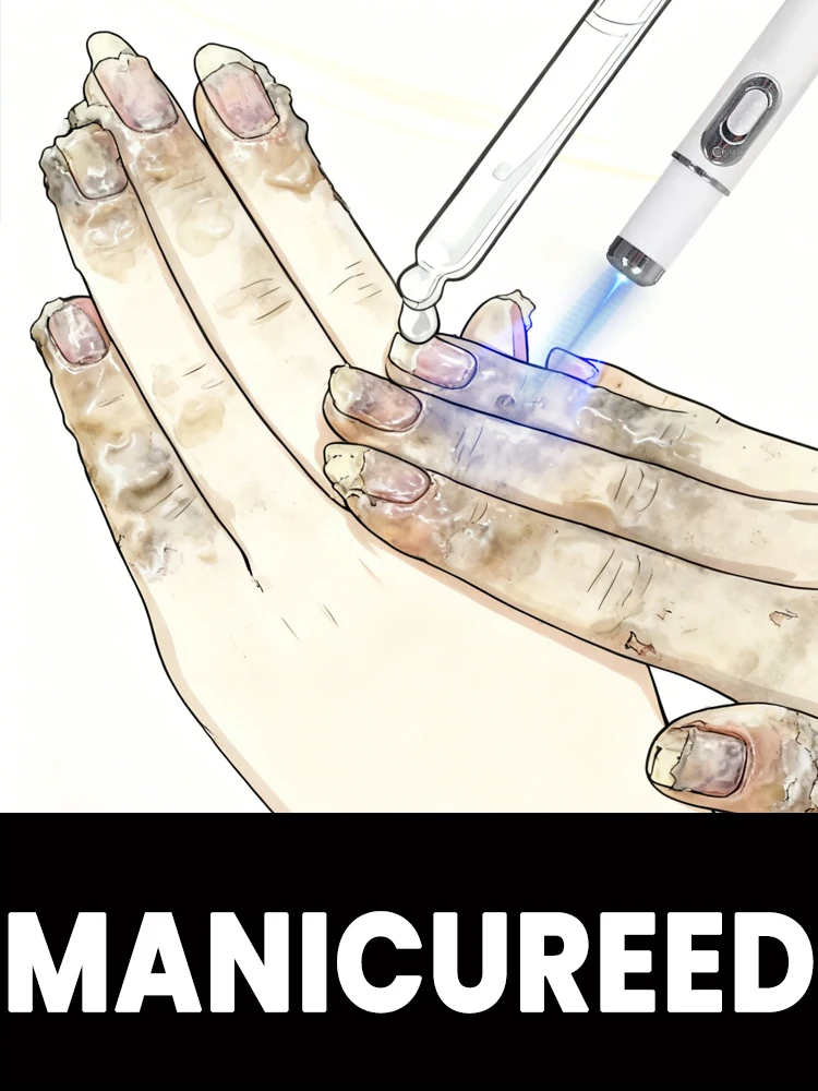 يغير الحياة وقلم ليزر للأظافر بلون الشمبانياs sыs. ر