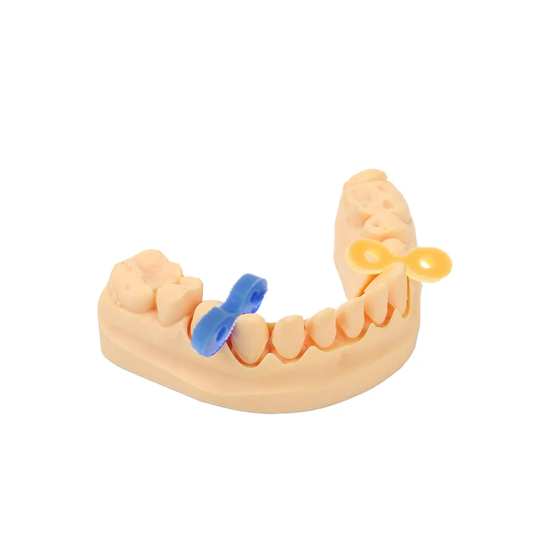 40 pz/scatola cunei di fissaggio in gomma elastica dentale matrici a matrice diga separatore di denti composito strumenti di accessori per odontoiatria