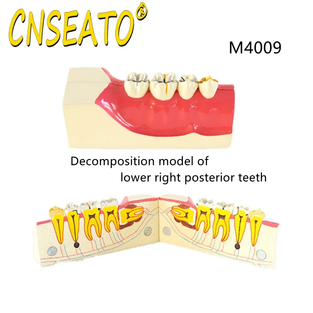 

CNSEATO Dental Study Model Right Lower Tooth Decomposition Model Denture Teaching Anatomy Tissue Display Dentistry Materials