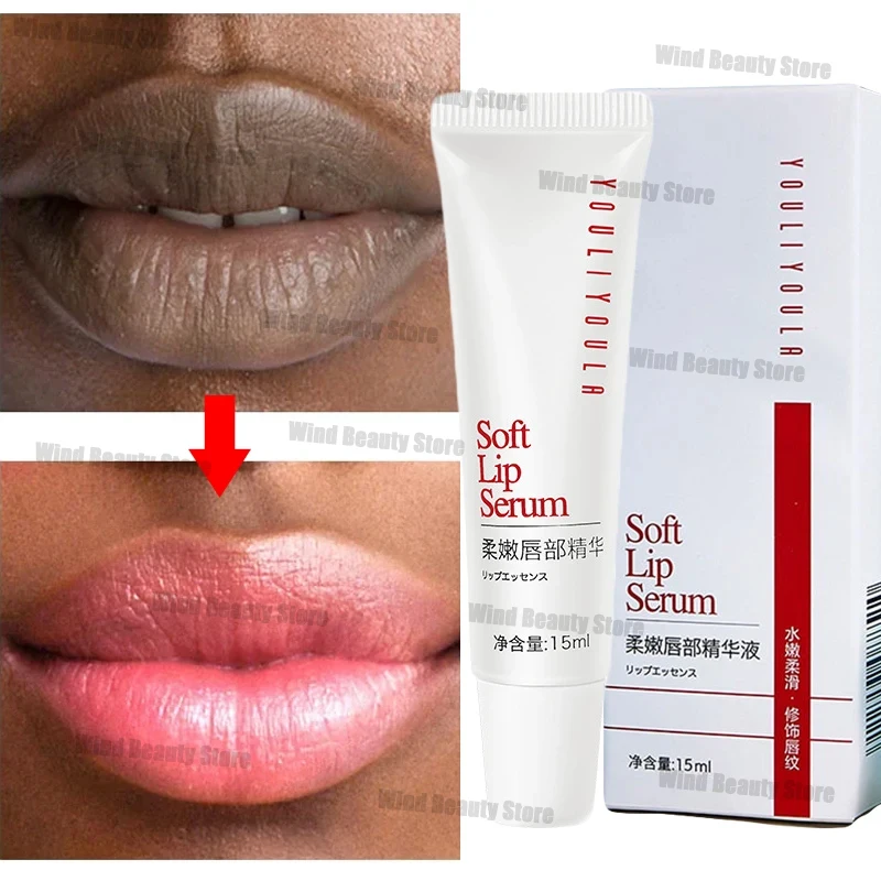 Fast Lightening Pink Mouth Lips Serum Bleaching Permanent Remove Dark Smoke Lips Lip Balm Moisturize Gloss Lipstick Lip Mask