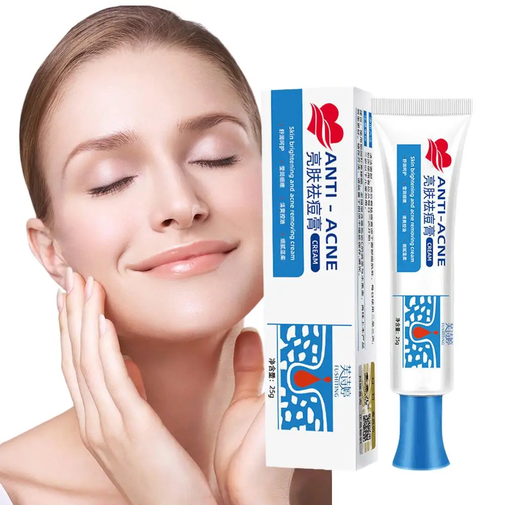 Crema Facial para eliminación de acné, crema para eliminar espinillas, Gel para marcas de poros, tratamiento de desvanecimiento de manchas, encogimiento de la piel, blanqueamiento, hidratante, P5J4, 25g