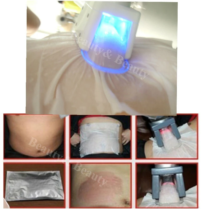 Bantalan selulit Gel Film antibeku, Anti beku, untuk krioterapi, sedot lemak, pendingin Cryo Lipo, penurun berat badan