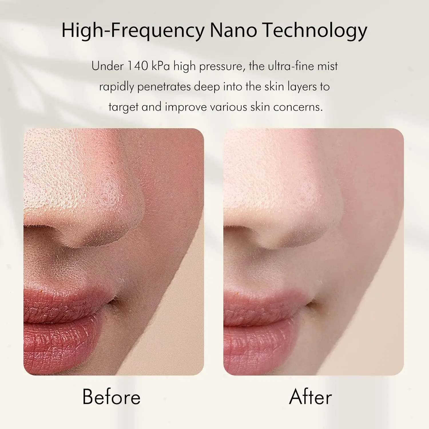Nano İyonik Soğuk Buharlı Yüz - Face Steamer incelemesi ve fiyatı