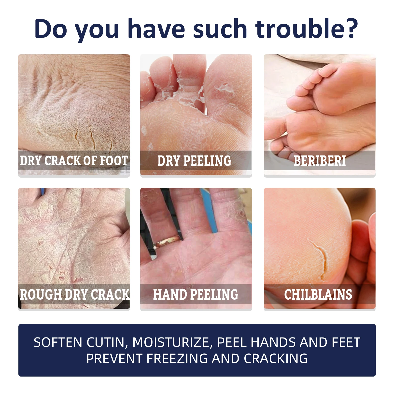 Jaysuing Anti Crack Hand Foot Cream Non Greasy Moisturizing Nourish Anti Drying Rough Hands Feet Winter Dry Crack Repair Lotion