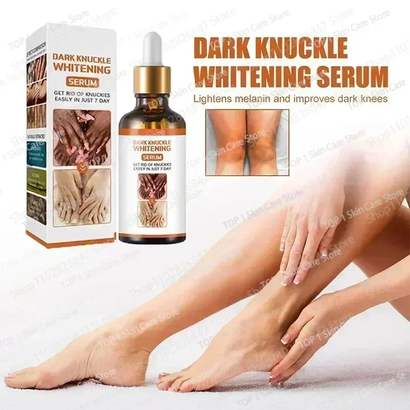 Hot sales knuckles whitening Essence For Lip Areolas Private Parts Tender Remove Intimate Melanin Skin Care Whitening Dark Spot