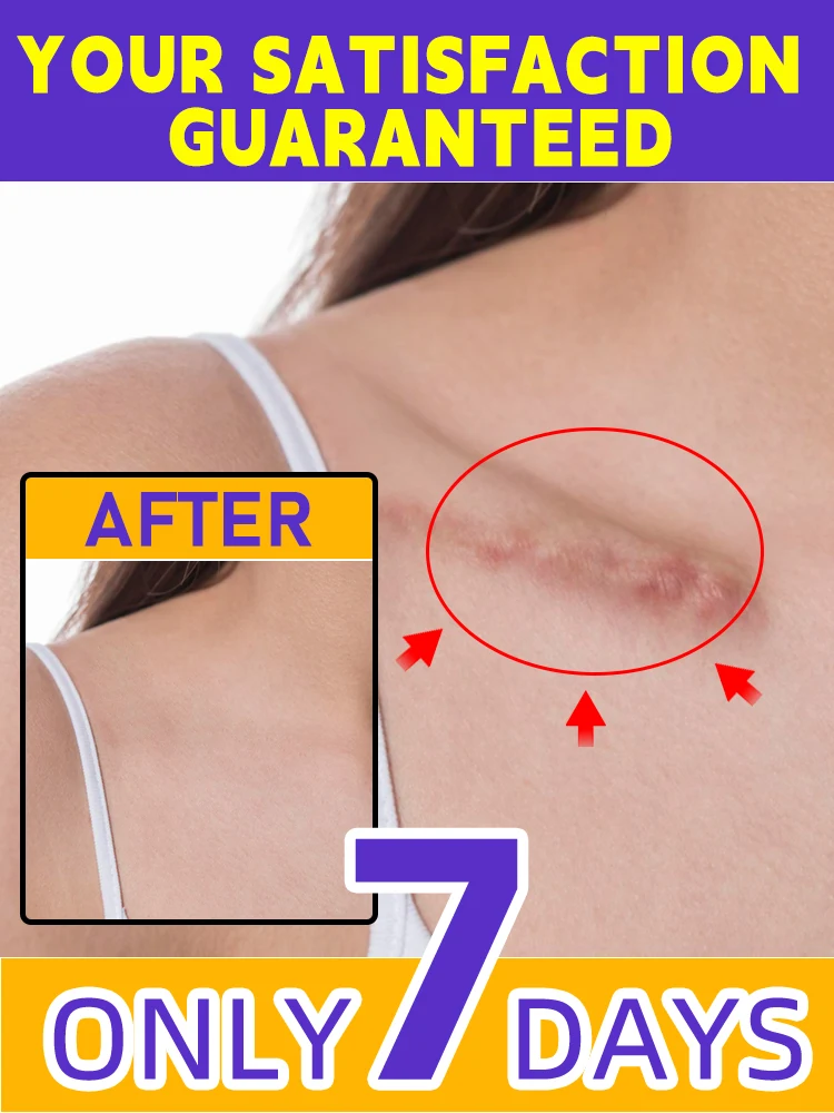 

Repair bumpy scars in 7 days