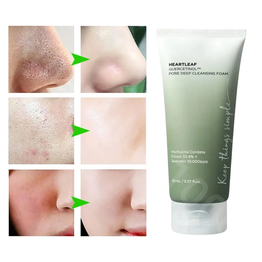 Anu Heartleaf 77% Skin Care Moisturizing Face Wash Foam for Blackhead Oil Control Pore Deep Cleansing Facial Cleanser 150ml