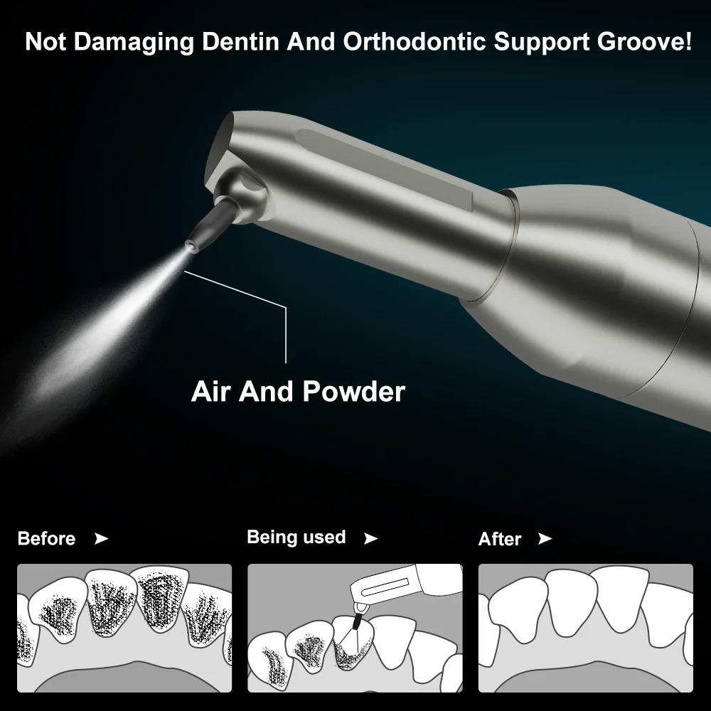 Dental Aluminum Oxide Micro Blaster Microetcher Alumina Sandblasting Gun Air Polisher Intraoral Teeth Whitening ISO AI-AP1