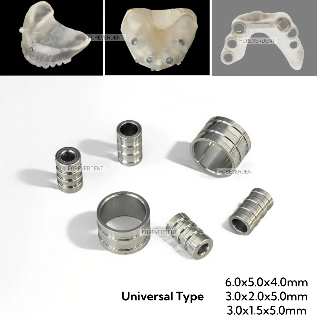 

Dental Digital Universal Type Guided Sleeves Digital Implant Planning Template Drill Guided Dia-1.5/2.0/5.0mm
