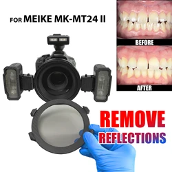 Dental Photo. CPL Polarizing Filter For MEIKE MK-MT24 Flash Set. Remove Reflections And Glare In Dental Photography