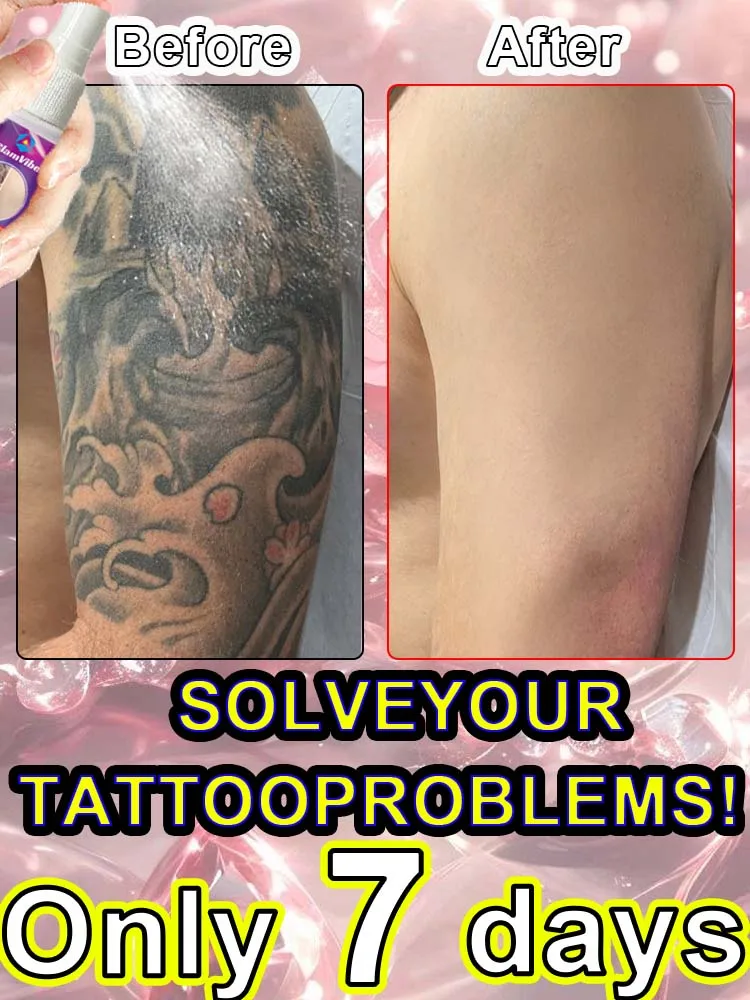 

Tattoo removal spray: Any color can be removed without damaging the skin.