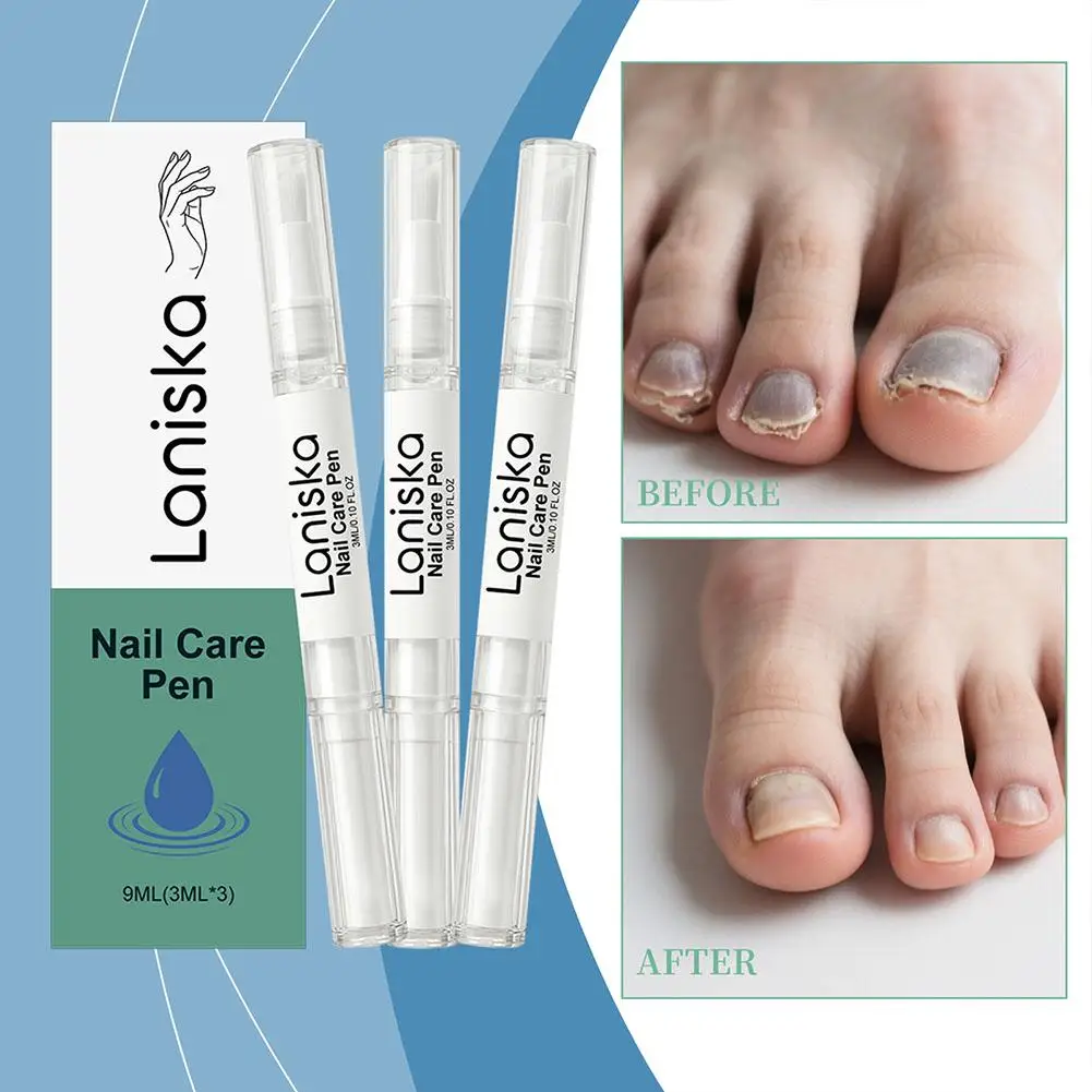 3pcs Nail Care Pen Cuticle Care Pen Reduce Breakage Damage Strengthening Moisturizing for Brittle, Fragile Cracked Nails 3mlX3
