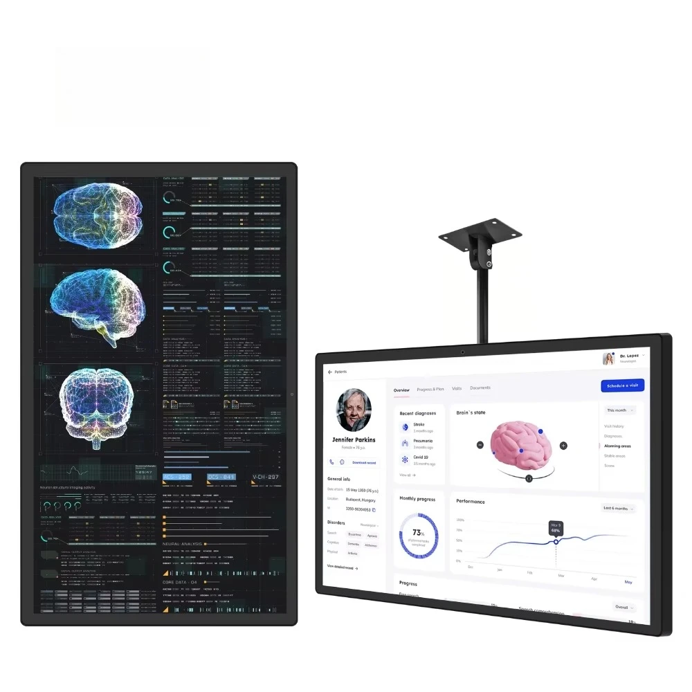 

15.6 27 32 43 55 Inch High Definition Lcd Medical Endoscopy Monitor for 4k Medical Display Touch Screen