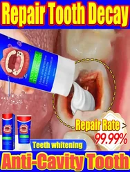 Anti Decay Toothpaste Dental Caries Repair Cream Prevent Tooth Decay Remove Plaque Toothache Relieve Periodontitis Protect Teeth