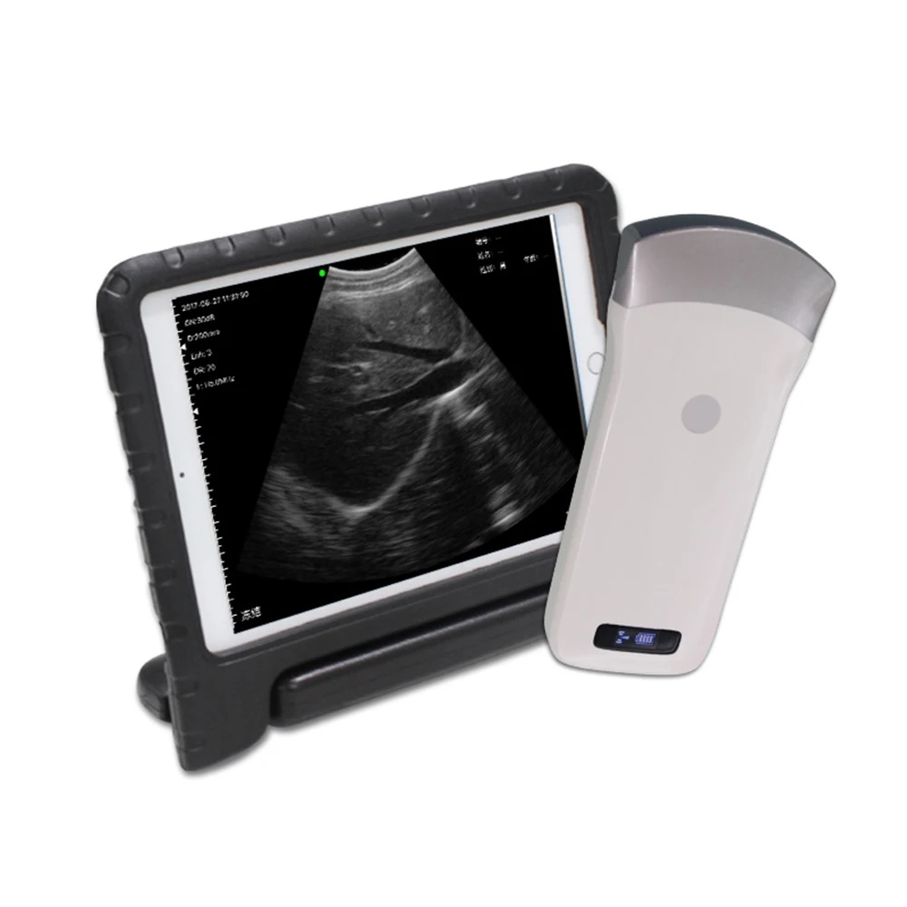 Portable Wireless Ultrasound Probe scanner Bluetooth machine WIFI ultrasound scanner Machine support iOS Android Windows