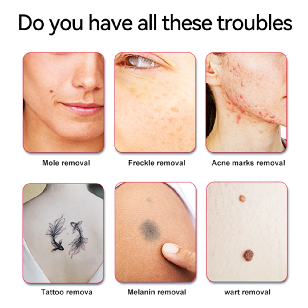 Lescolton เครื่องนวดเครื่องมือดูแลผิวหน้า LS-830/LS-831สำหรับไฝรอยสักแท็กกำจัดสิวหัวดำ