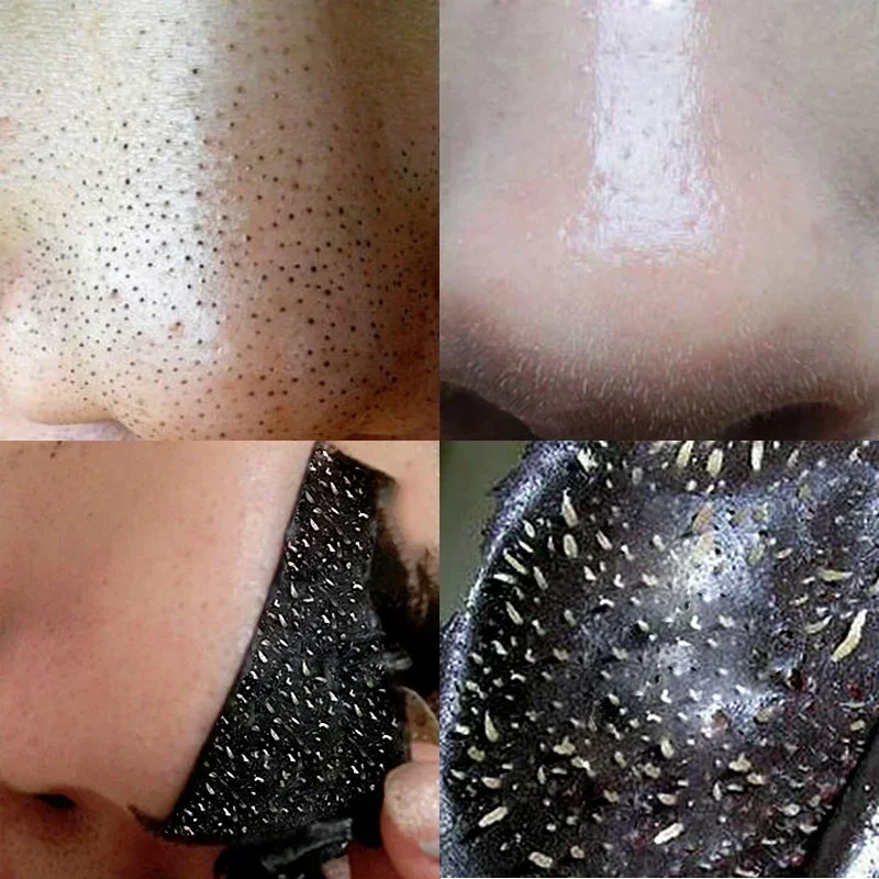 10 Uds mascarilla eliminadora de espinillas de nariz limpieza profunda mascarilla para tratamiento del acné del poro retráctil