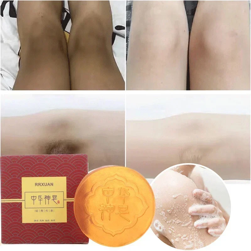 Body Whitening Soap Deep Clean Skin Chicken Skin Removal Soap Armpit Underarm Knees Bleaching Body Brighten White Care Products